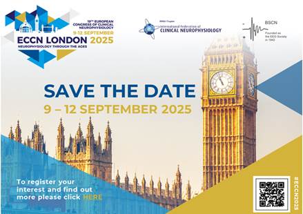 ReuniÓn Conjunta De La Red EspaÑola De EstimulaciÓn Cerebral Y De La AsociaciÓn EspaÑola De EstimulaciÓn Cerebral