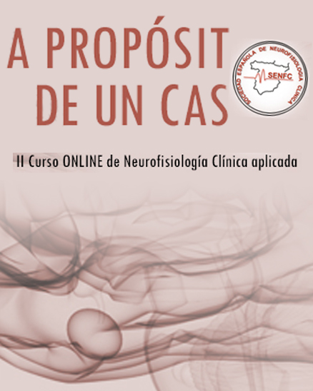 Curso de Potenciales Evocados