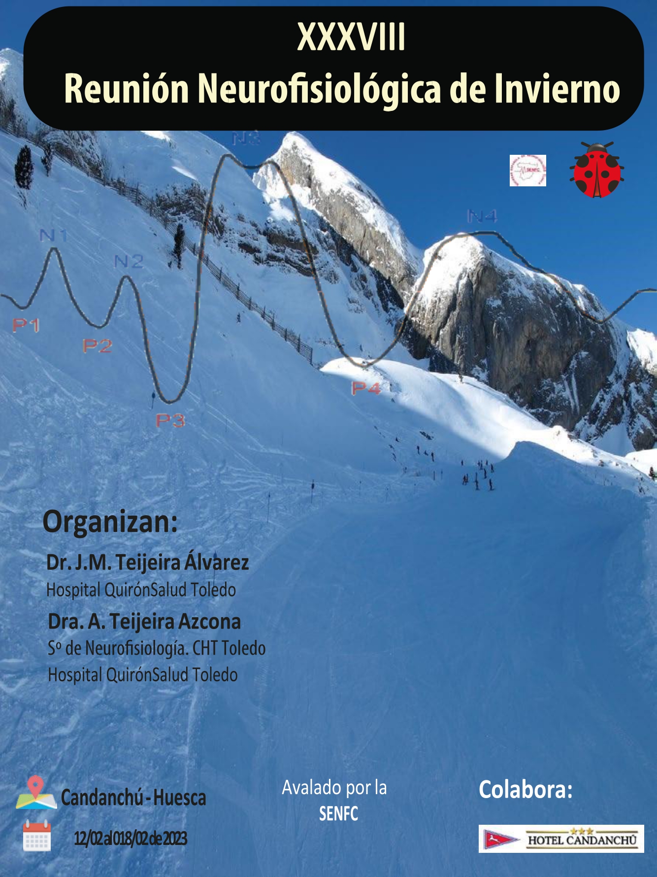 Curso de Potenciales Evocados