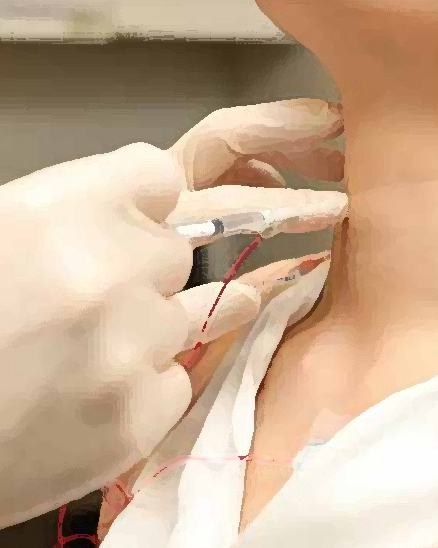 Curso de Potenciales Evocados