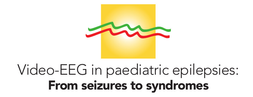 Curso de Potenciales Evocados