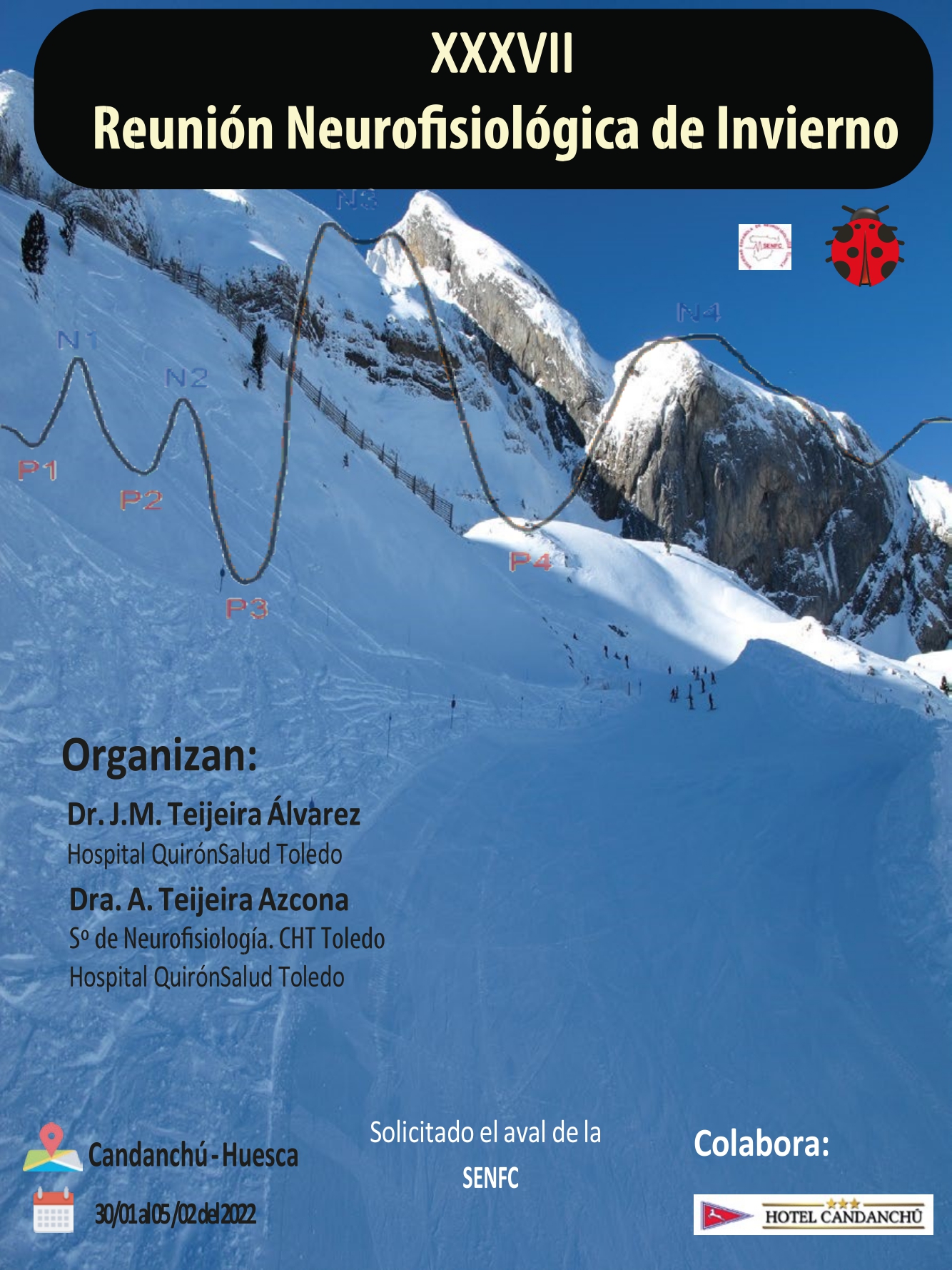 II Joint Meeting of the Spanish and Finnish Societies of Clinical Neurophysiology