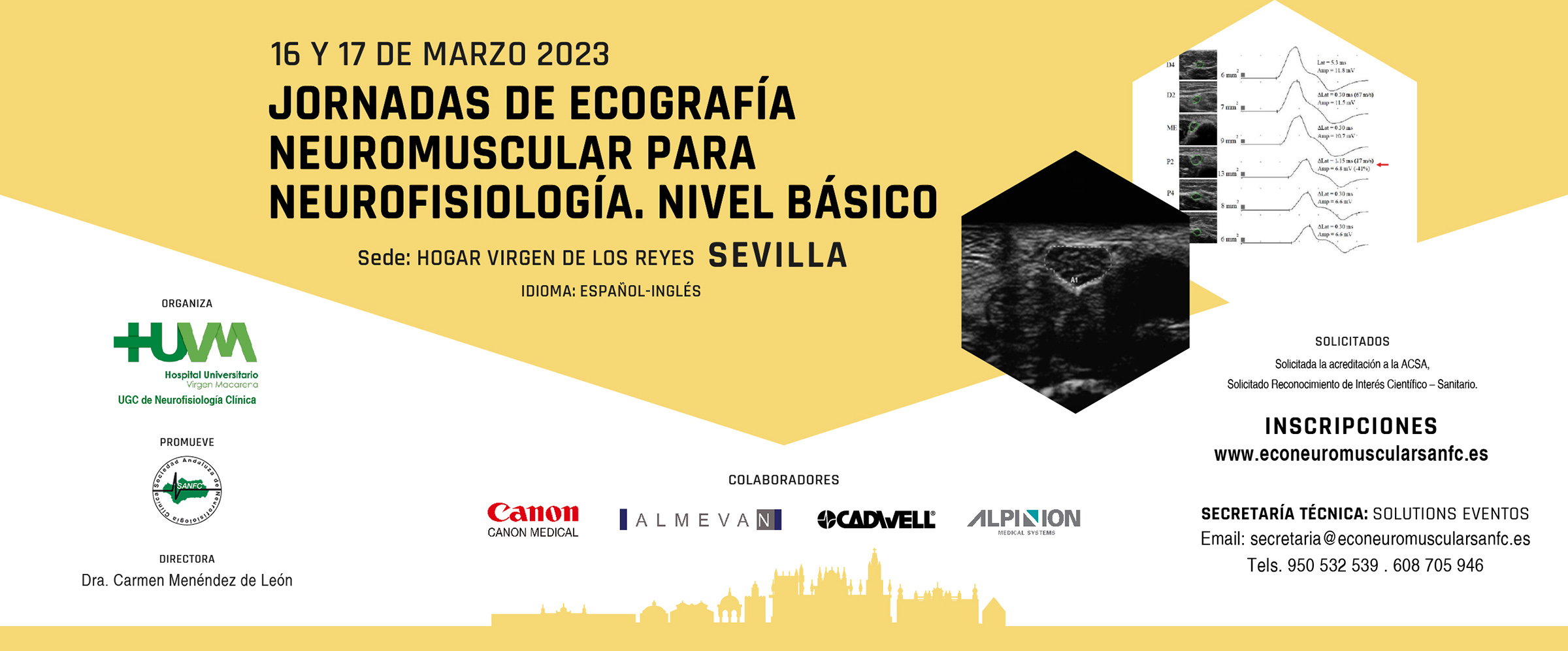 Curso de Potenciales Evocados